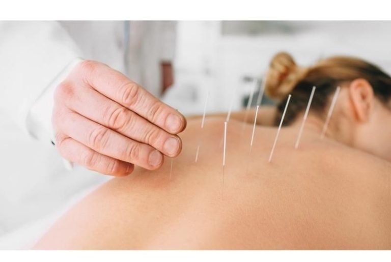The not so mysterious healing of acupuncture
